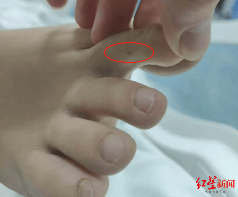 官方介入调查“27岁女子三亚旅游疑被不明物咬伤身亡”事件 家属：未来有考虑尸检